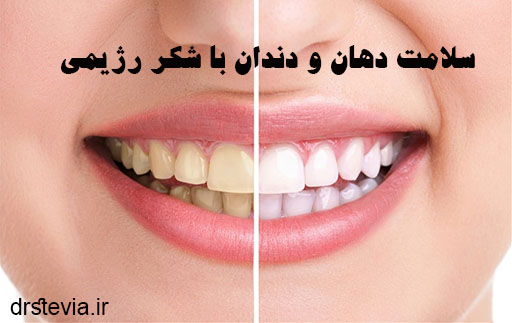 سلامت دهان و دندان با شکر رژیمی